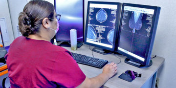 ACTIVAN HORARIO VESPERTINO PARA MASTOGRAFÍAS, EN CENTRO ESTATAL DE ONCOLOGÍA