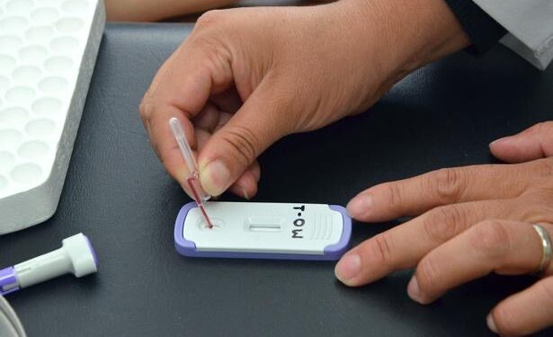 Brinda IMSS BCS tratamiento a 756 personas que viven con VIH