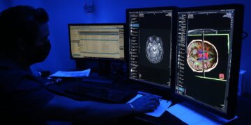 Brinda Issste terapias avanzadas de ingeniería genética a pacientes con enfermedades raras