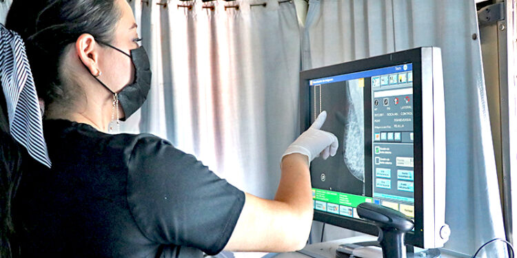 MASTÓGRAFO MÓVIL ESTATAL INICIÓ RECORRIDO EN COMONDÚ