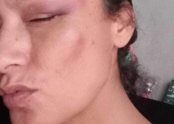 Policías Municipales de La Paz Investigados por Agresión a Esposa de Compañero Policía