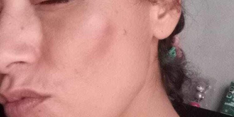 Policías Municipales de La Paz Investigados por Agresión a Esposa de Compañero Policía