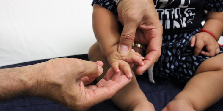 TIENEN MAYOR BIENESTAR LAS Y LOS SUDCALIFORNIANOS ATENDIDOS CON CIRUGÍAS DE MANOS Y PIES&nbsp;