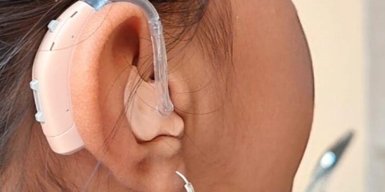 Programa “Ponte Oreja”