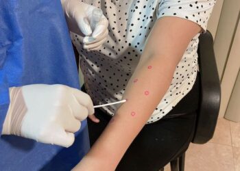 LA TOTALIDAD DE CASOS CONFIRMADOS POR MPOX EN BCS CURSAN LA ENFERMEDAD SIN COMPLICACIONES 