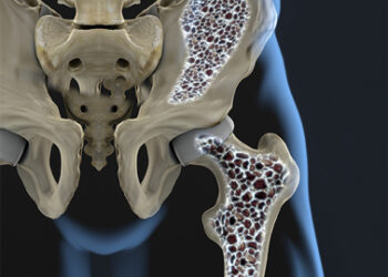 Biotecnología y osteoporosis: avances en Baja California Sur para combatir esta “enfermedad silenciosa”