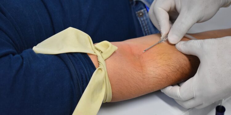 Invita IMSS Baja California Sur a Jornada de Donación Altruista de Sangre