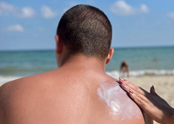 ☀️ IMSS BCS advierte sobre daños irreversibles en la piel por exposición al sol sin protección